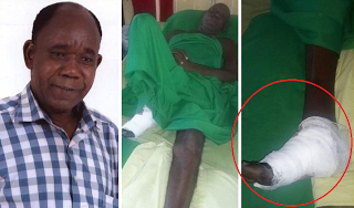 Veteran Actor Tunde Alabi has Right leg Amputated due to lack of Funds