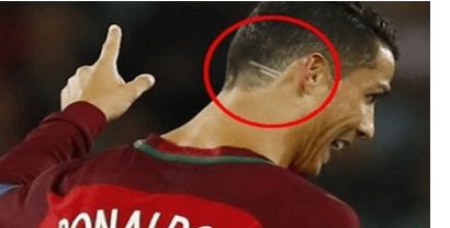 THE WHOLE WORLD IS IN TEARS: They Discovered What These 2 LINES on Ronaldo’s Head Means-shocking!!!