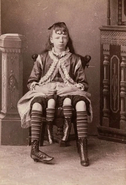 True Story Of Josephine Myrtle Corbin, The Lady Born With Four Legs & Two Private Parts (Photos)