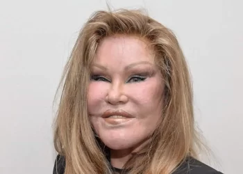 Jocelyn Wildenstein Before Plastic Surgery: See Her face Different look