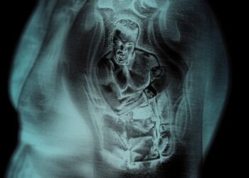 Ruger – Muhammad Ali (Can’t Relate) (Remix) ft. Ayetian